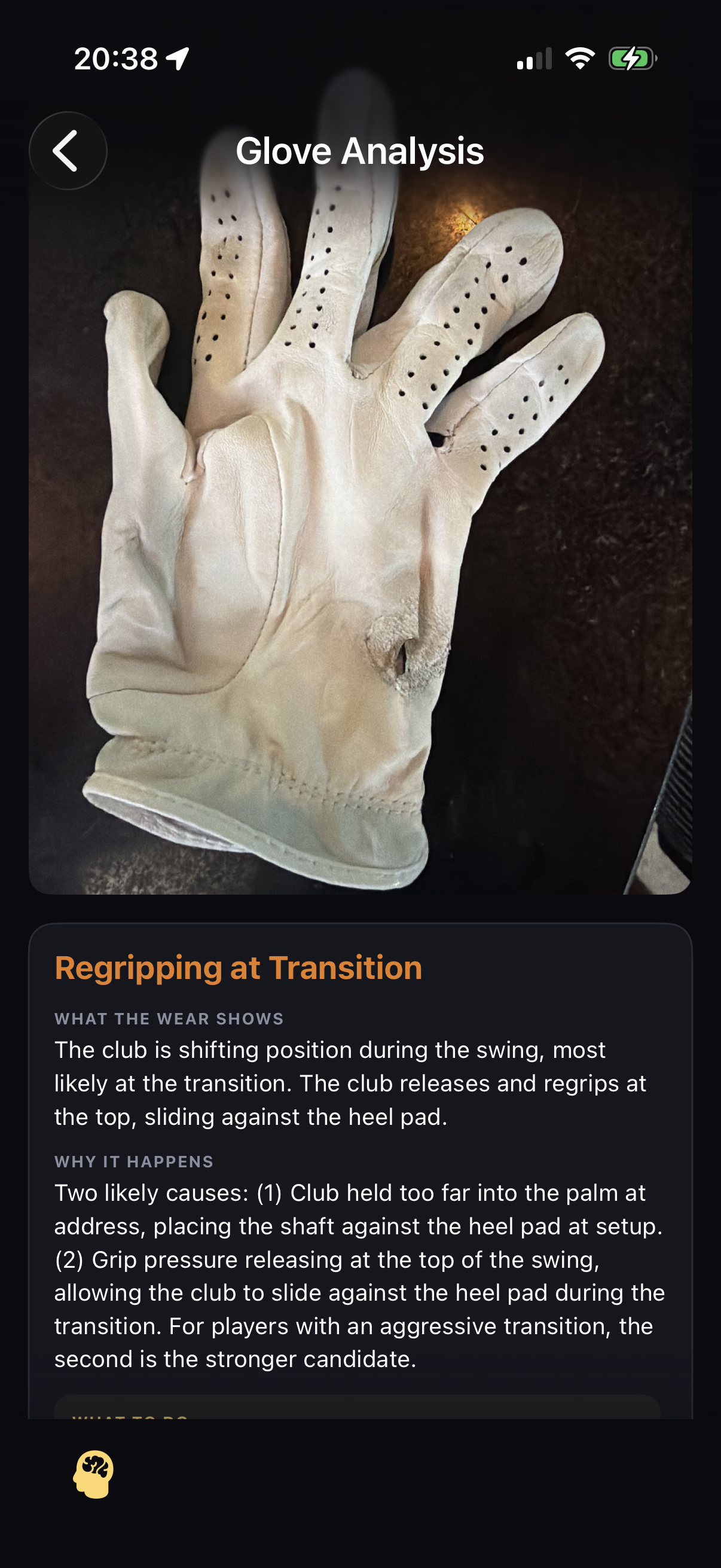 Glove Analysis — wear pattern diagnosis from photo
